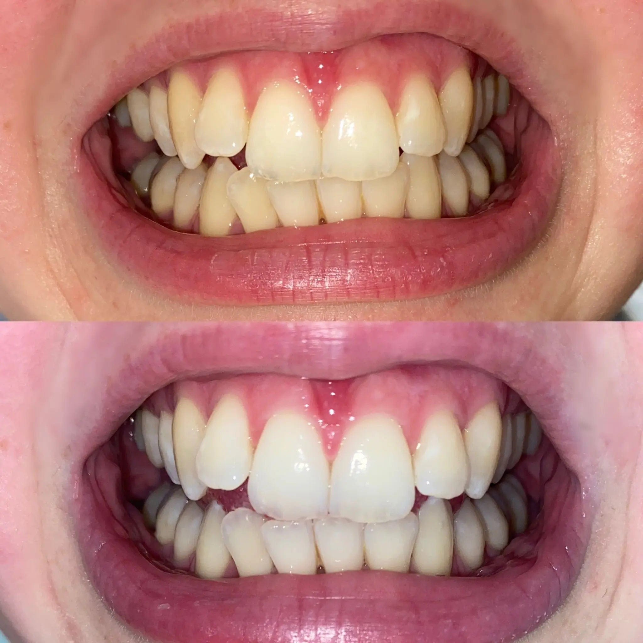 Bright Smile PAP+ Teeth Whitening Powder Bright Smile